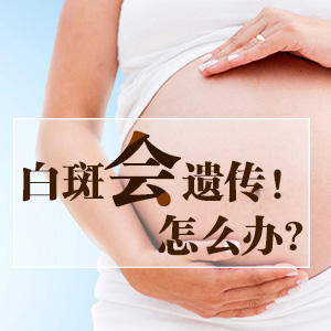 成都白癜风哪个医院好